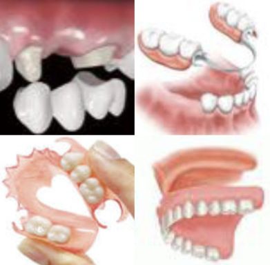 Rehabilitación Oral